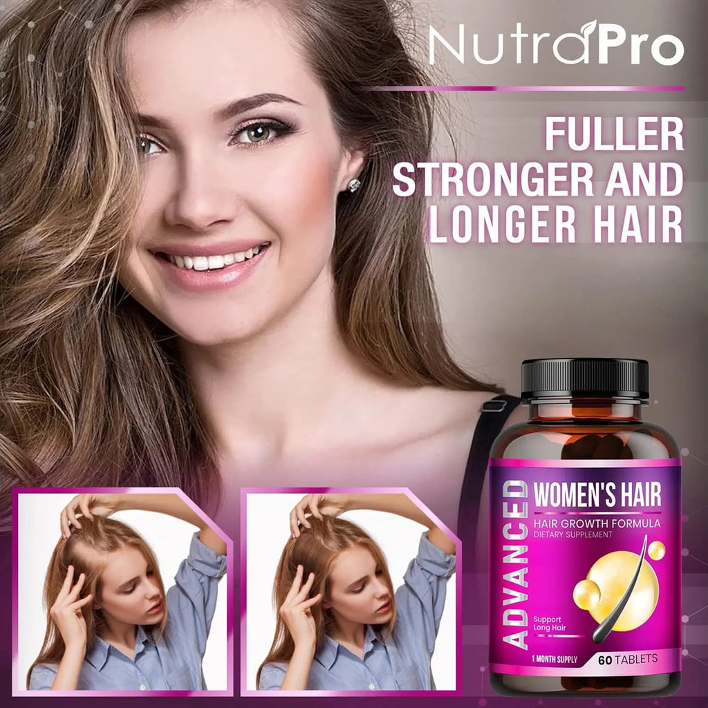 Hair Growth Vitamins for Women - Hair Vitamins for Thinning Hair for Women .Regrow & Regrowth Hair Supplement with Dht Blocker,Biotin & Saw Palmetto for Women.Volumize,Thicker,Longer Hair. Flyobi