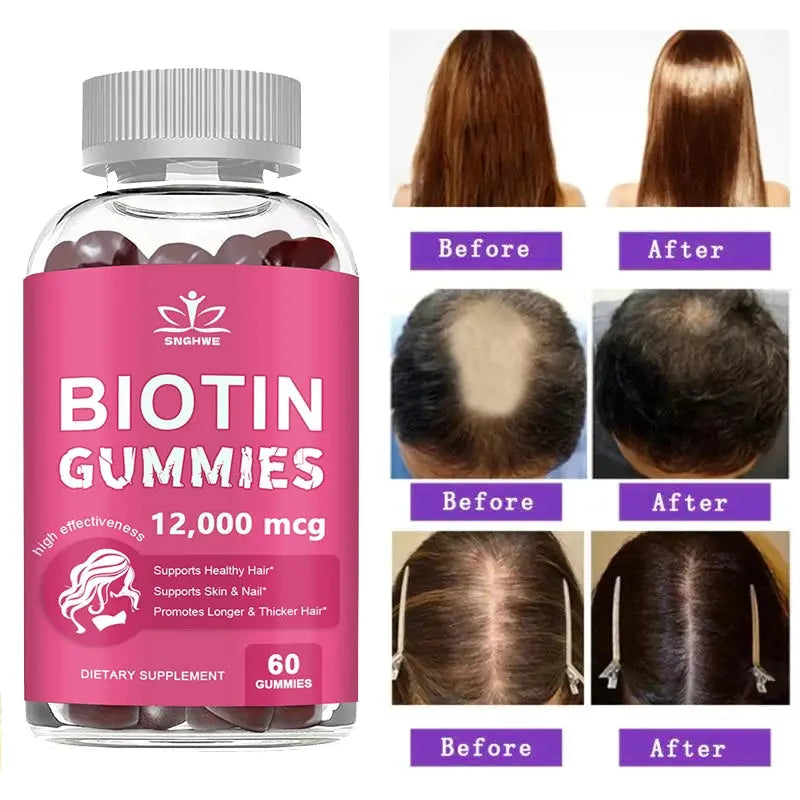 Collagen Gummies Biotin Gummies for Skin Care Health Nails Hair Growth Vitamins Collagen Protein Supplement Flyobi