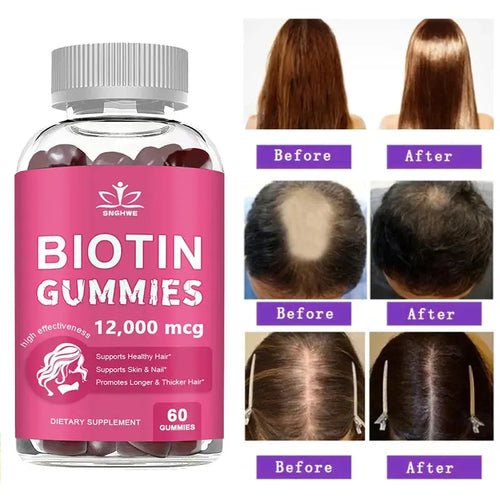Collagen Gummies Biotin Gummies for Skin Care Health Nails Hair Growth Vitamins Collagen Protein Supplement Flyobi